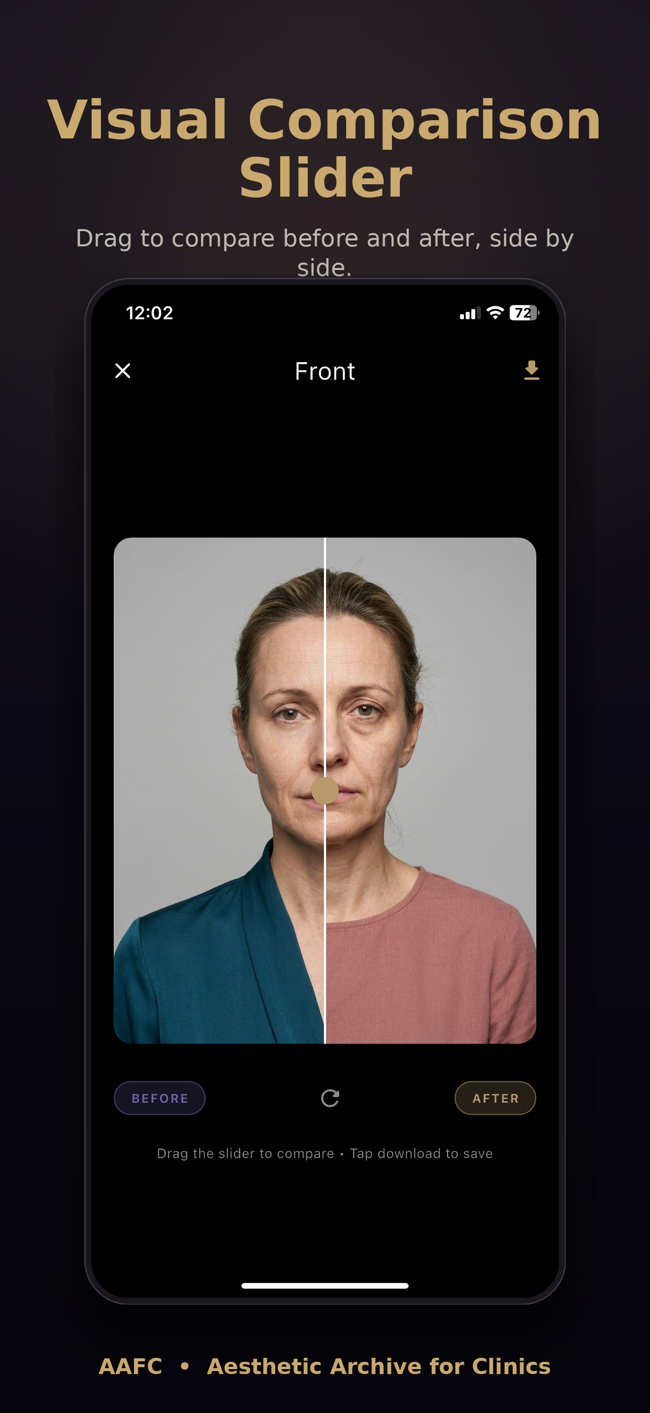 Visual comparison slider
